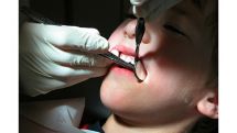 Ученые разработали вакцину, предотвращающую кариес и разрушение зубов