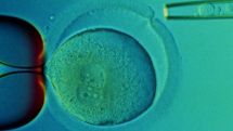 Stem cells help nearly blind see