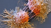 Cancer gene test 'would save lives'