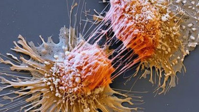 Cancer gene test 'would save lives'