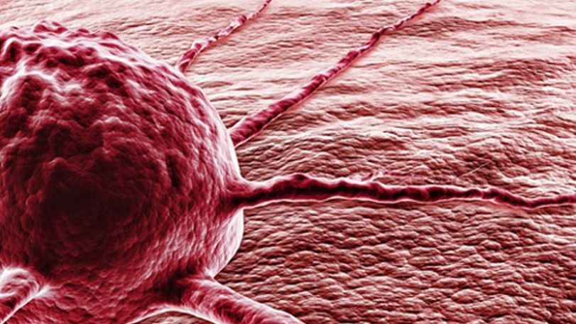 Free treatment for cancer patients by priority