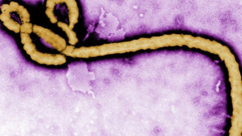 Japanese researchers develop 30-minute Ebola test