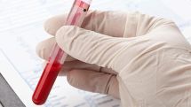 Armenian authorities probing case involving HIV-affected child