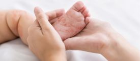 More than 140,000 die from measles as cases surge worldwide