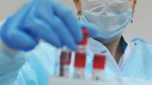 Commission set up to prevent the spread of coronavirus in Armenia