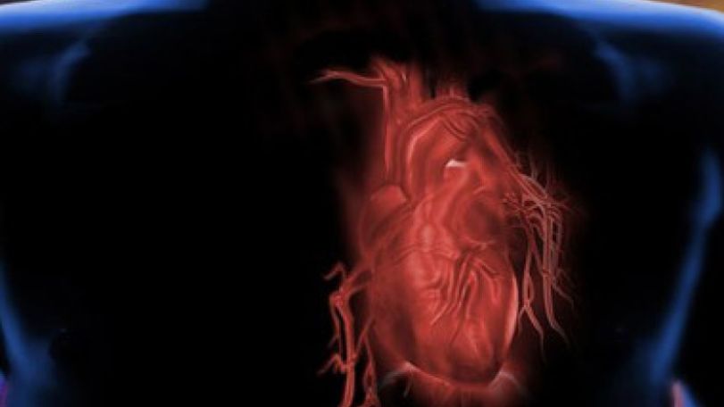 Heart disease giving way to cancer as top killer of men