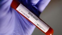 Azerbaijan reports first case of coronavirus