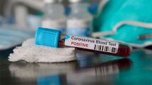 Выявлен уже второй случай заражения коронавирусом в Грузии