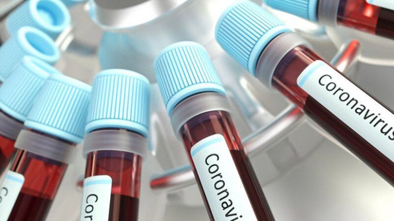 Eight more suspected coronavirus cases test negative in Armenia
