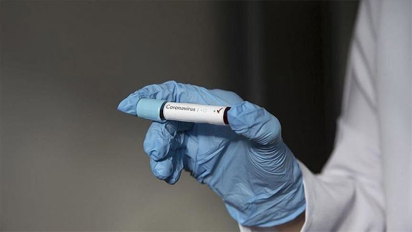 Belarus has 27 cases of coronavirus: health ministry