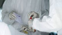 Government official: Coronavirus vaccine trial starts on Monday