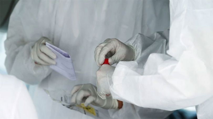 Government official: Coronavirus vaccine trial starts on Monday