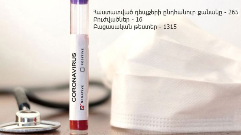 25.03.2020. Կորոնավիրուսի հիվանդացության 265 հաստատված դեպք կա