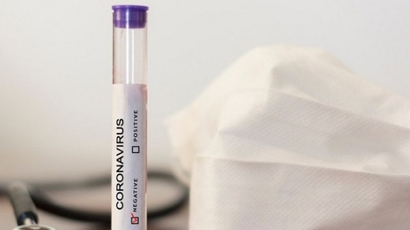 Two more patients recover from coronavirus in Armenia- health minister