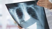 Minister: Possibility of producing ventilators being considered