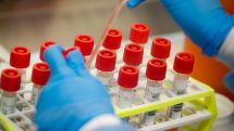 Armenia’s Gegharkunik Province reports 6 new cases of COVID-19