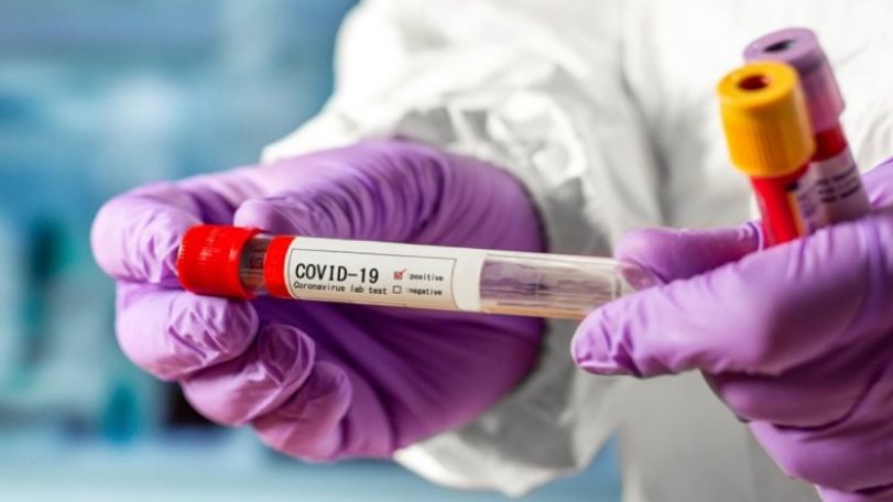 Three recovered coronavirus patients test positive again in Armenia – health minister