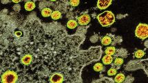 Coronavirus infections top 5 million worldwide
