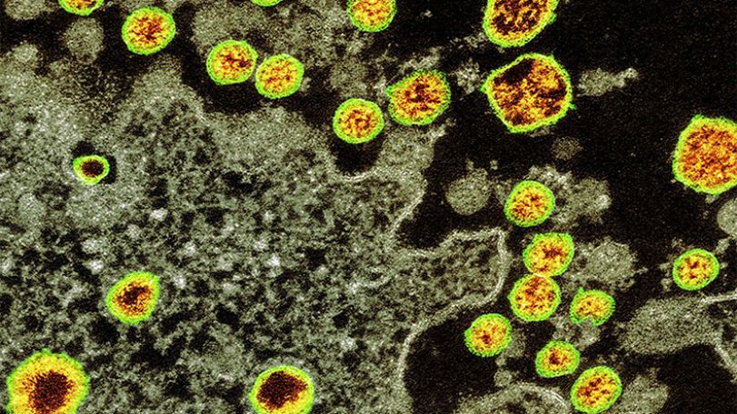 Coronavirus infections top 5 million worldwide