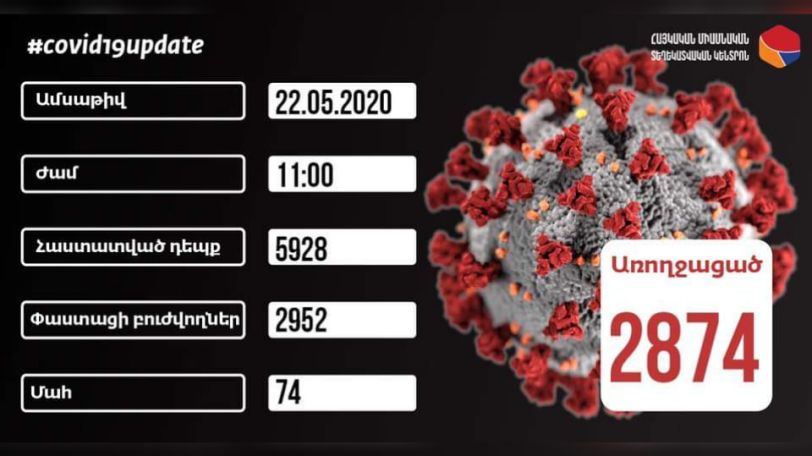 Coronavirus: Armenia reports 322 new cases, 293 recoveries on May 22