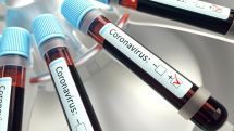 В Грузии из общего числа инфицированных COVID-19 вылечились 72%