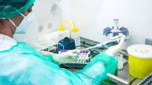 Health minister: Some 15-20% of confirmed coronavirus cases require hospitalization
