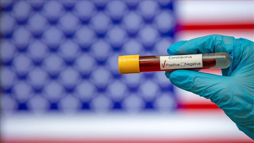 За сутки в США зафиксировано свыше 24 тысяч новых случаев заражения COVID-19
