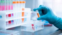 Coronavirus outbreak closes two textile factories in Gyumri