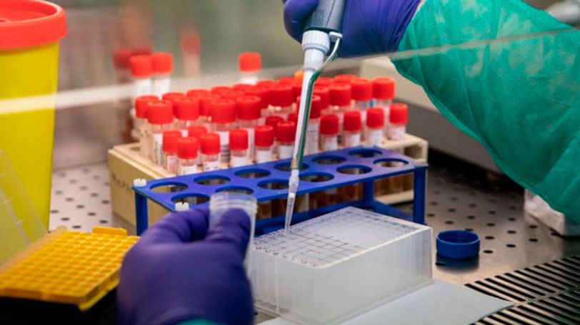 Замглавы Минздрава Армении: Расширены объемы тестирования на COVID-19