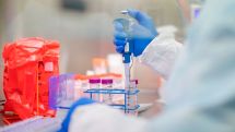 Over 100 coronavirus patients in critical condition in Armenia