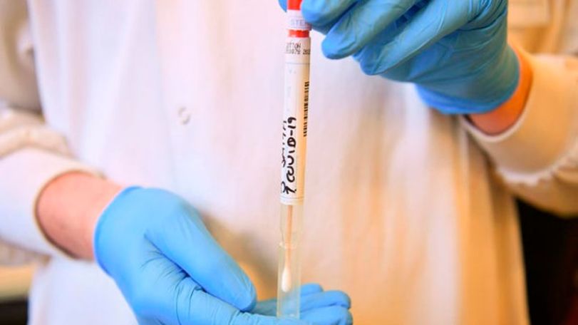 971 health workers infected with coronavirus in Armenia