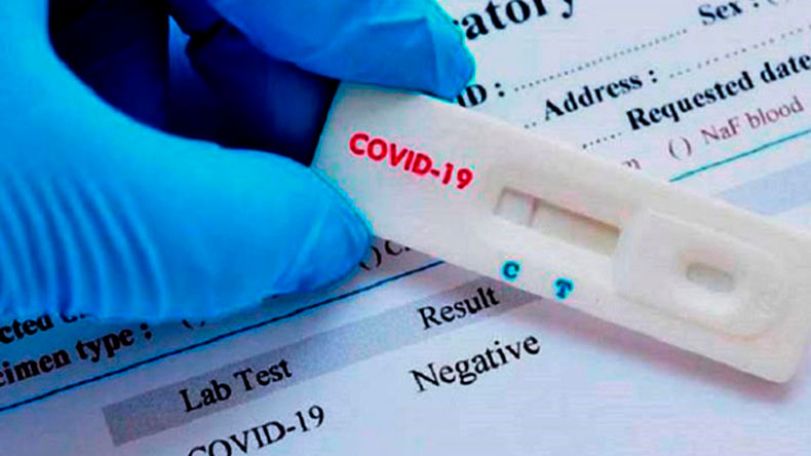 Artsakh reports 10 new coronavirus cases on July 22