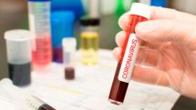 Artsakh reports no new coronavirus cases for second day in a row