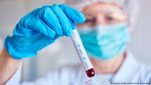 New coronavirus epicenter reported in Stepanakert