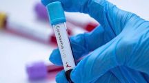 Two coronavirus patients in Artsakh are in serious condition