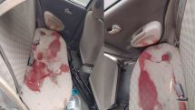 Автомобиль, перевозивший раненых в Арцахе журналистов: фото