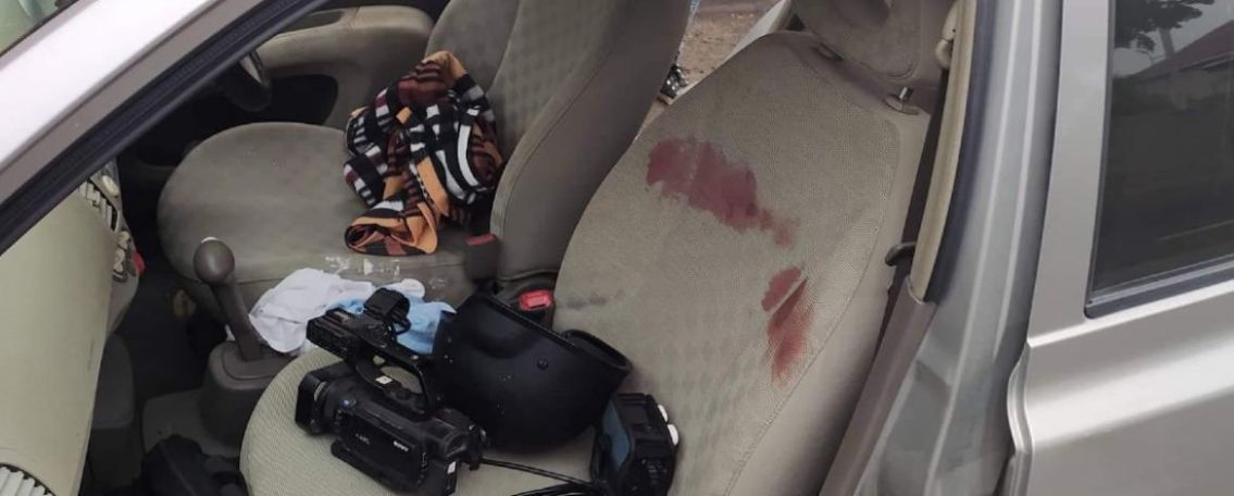 RSF: Shelling that targeted reporters in Nagorno-Karabakh ‘unjustifiable’