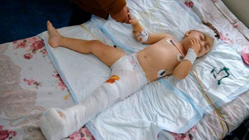 Получивший в результате бомбардировки в Арцахе ранения 2-летний ребенок уже прооперирован