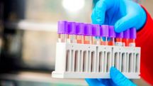Armenia to receive 50,000 new antigen tests for coronavirus