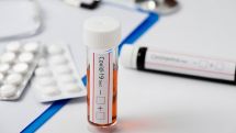 Four Armenian footballers test positive for coronavirus ahead of North Macedonia clash