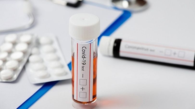 Four Armenian footballers test positive for coronavirus ahead of North Macedonia clash
