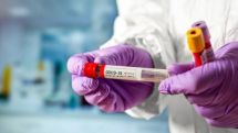 Georgia reports 3,487 new coronavirus cases, total reaches 198,387