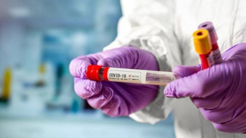 Georgia reports 3,487 new coronavirus cases, total reaches 198,387