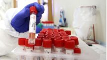 Georgia reports 2,904 fresh COVID-19 cases