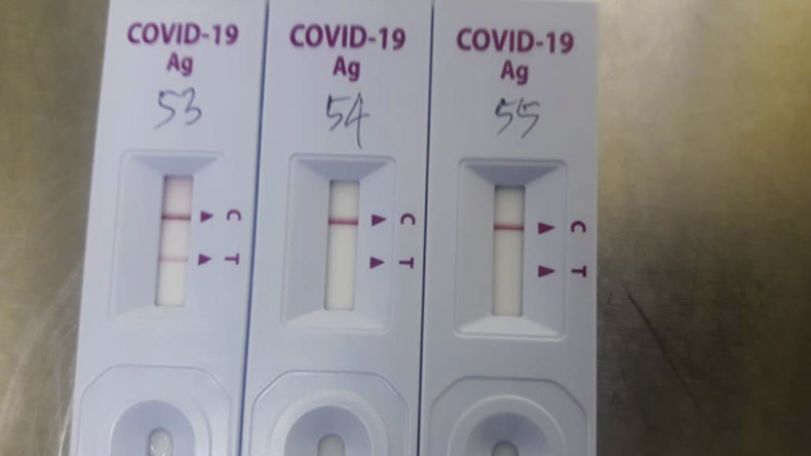 WHO delivered 40,000 Covid-19 rapid antigen tests to Armenia