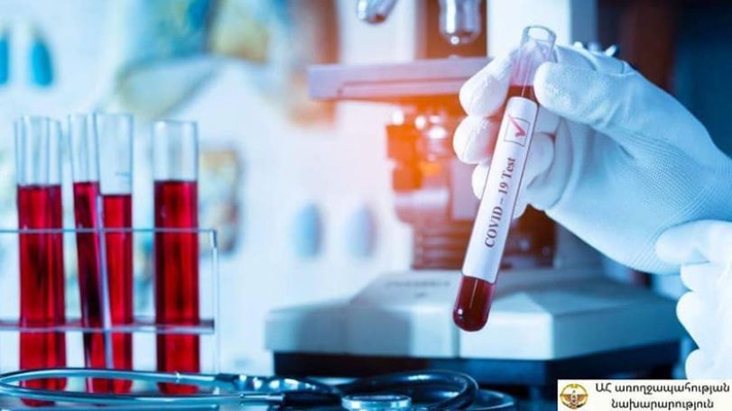 В Арцахе выявили 8 новых случаев COVID-19