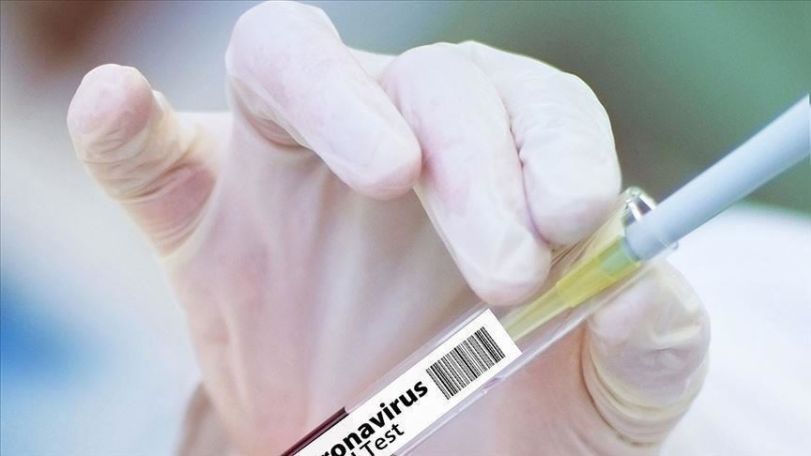 Россия разработала первую в мире тест-систему для выявления британского штамма коронавируса