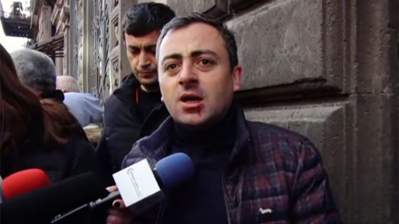 Ոստիկանները մարմնական վնասվածք պատճառեցին Իշխան Սաղաթելյանին