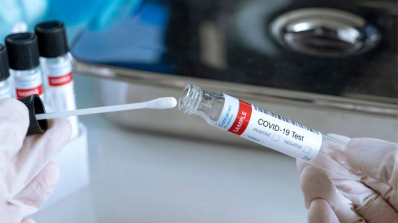 В Арцахе подтверждены 10 случаев COVID-19
