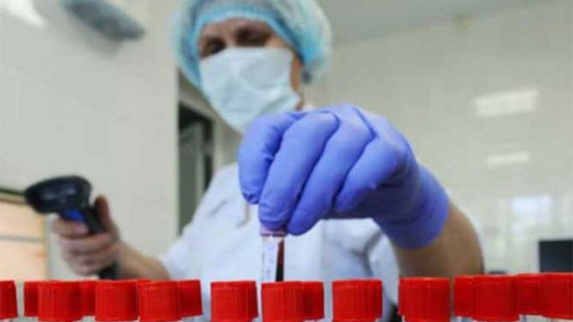 В Арцахе подтверждено 3 случая COVID-19